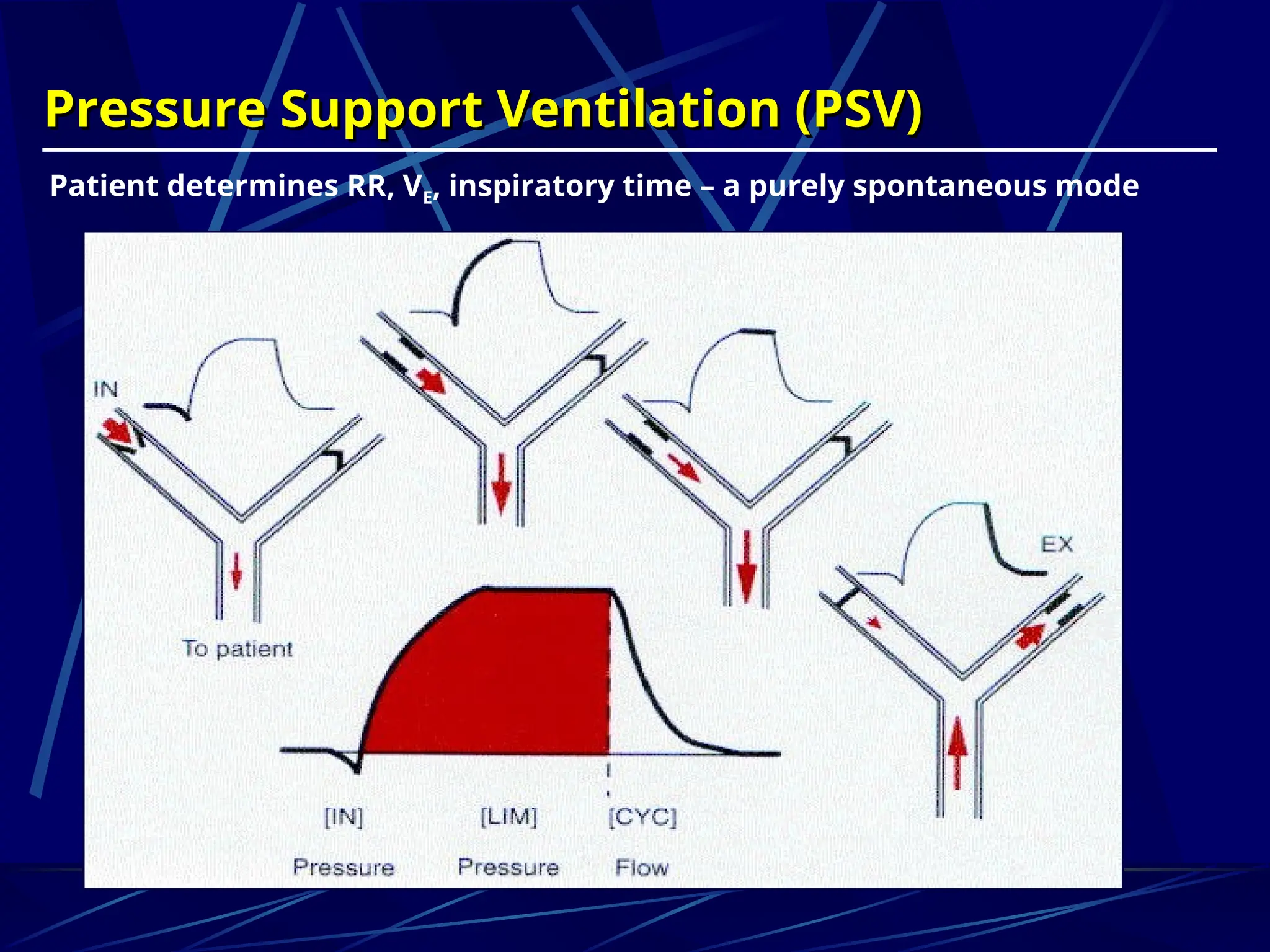 Pressure Support Ventilation (PSV)
Pressure Support Ventilation (PSV)
Patient determines RR, VE, inspiratory time – a purely spontaneous mode
 