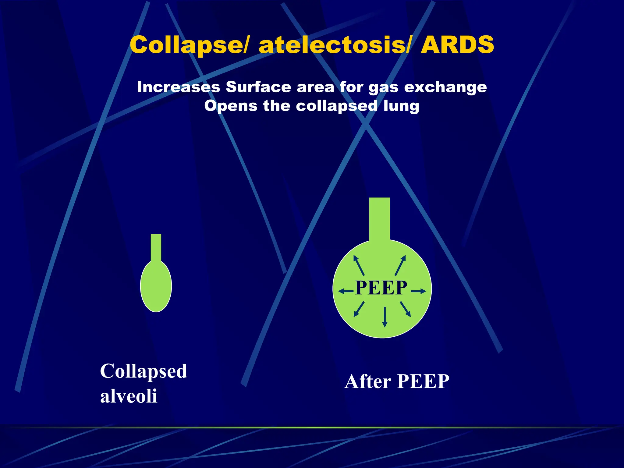 Collapse/ atelectosis/ ARDS
Increases Surface area for gas exchange
Opens the collapsed lung
Collapsed
alveoli
After PEEP
PEEP
 