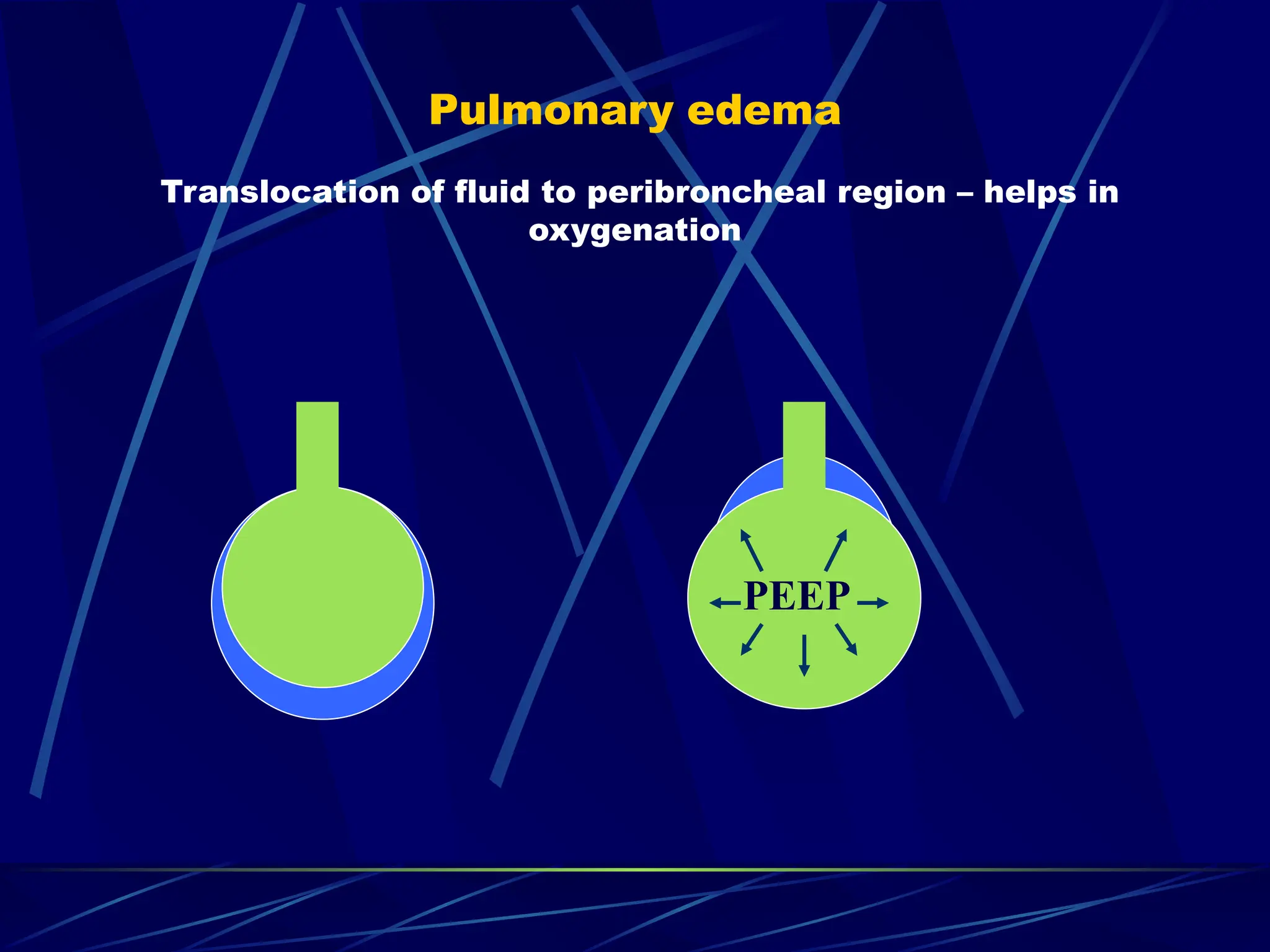 Pulmonary edema
Translocation of fluid to peribroncheal region – helps in
oxygenation
PEEP
 
