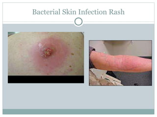 Basics of wounds, lumps, bumps, and rashes for gwep 2018 | PPTX
