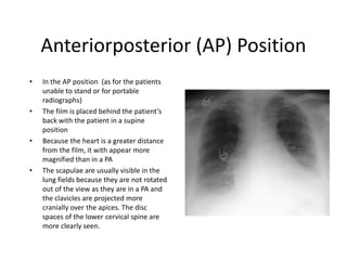 Ap Position Radiology Presentation on basics of X ray , CT and USG-1.pdf