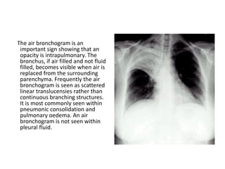 Presentation on basics of X ray , CT and USG-1.pdf