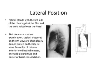Presentation on basics of X ray , CT and USG-1.pdf