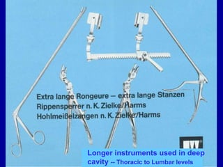 Longer instruments used in deep
cavity -- Thoracic to Lumbar levels
 