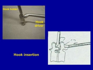 basic spinal instrument.docx