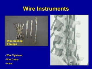 Wire Instruments
- Wire Tightener
- Wire Cutter
- Pliers
Wire holding
Forceps
 