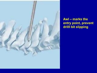basic spinal instrument.docx