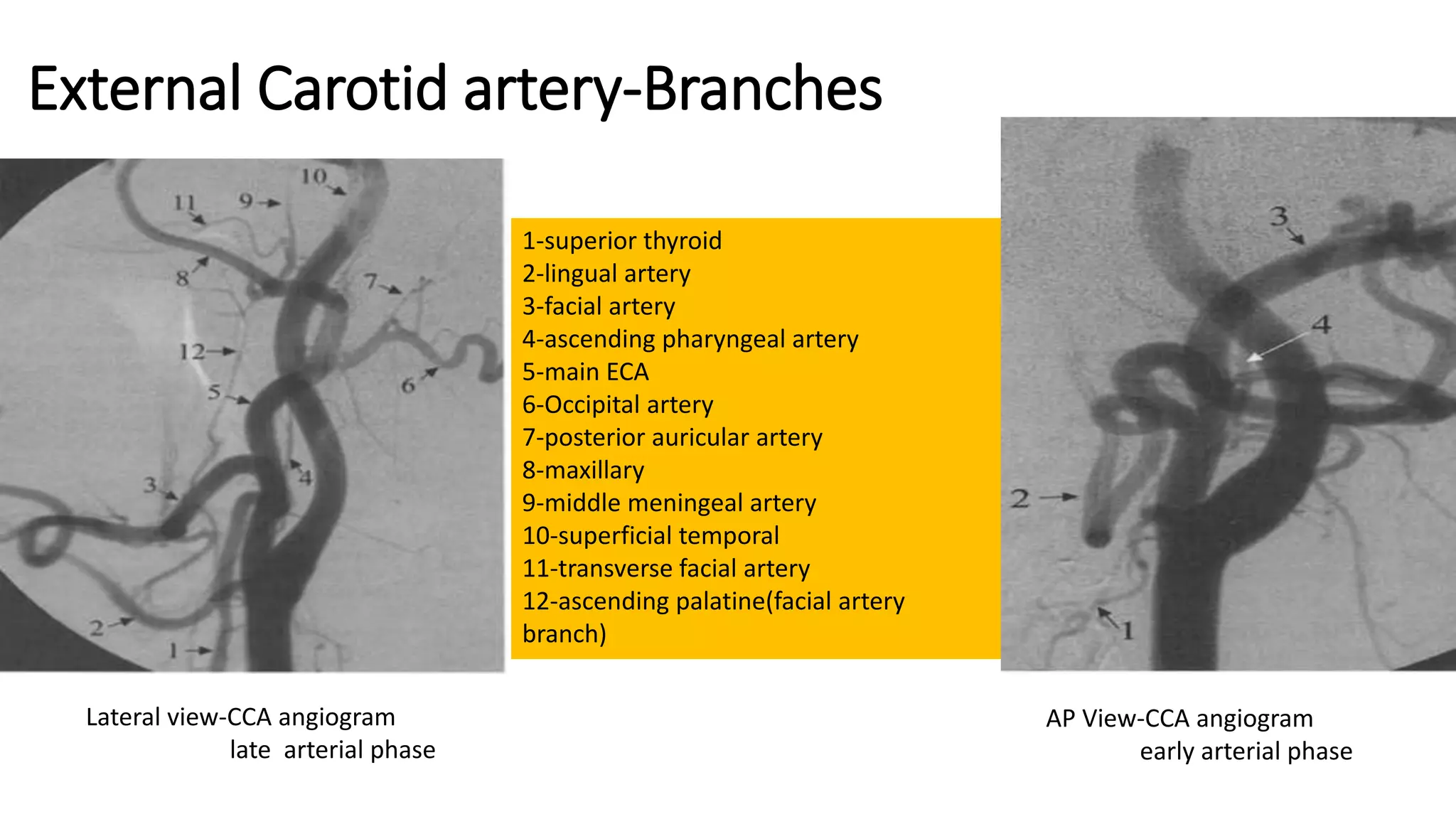 External Carotid artery-Branches
1-superior thyroid
2-lingual artery
3-facial artery
4-ascending pharyngeal artery
5-main ECA
6-Occipital artery
7-posterior auricular artery
8-maxillary
9-middle meningeal artery
10-superficial temporal
11-transverse facial artery
12-ascending palatine(facial artery
branch)
Lateral view-CCA angiogram
late arterial phase
AP View-CCA angiogram
early arterial phase
 