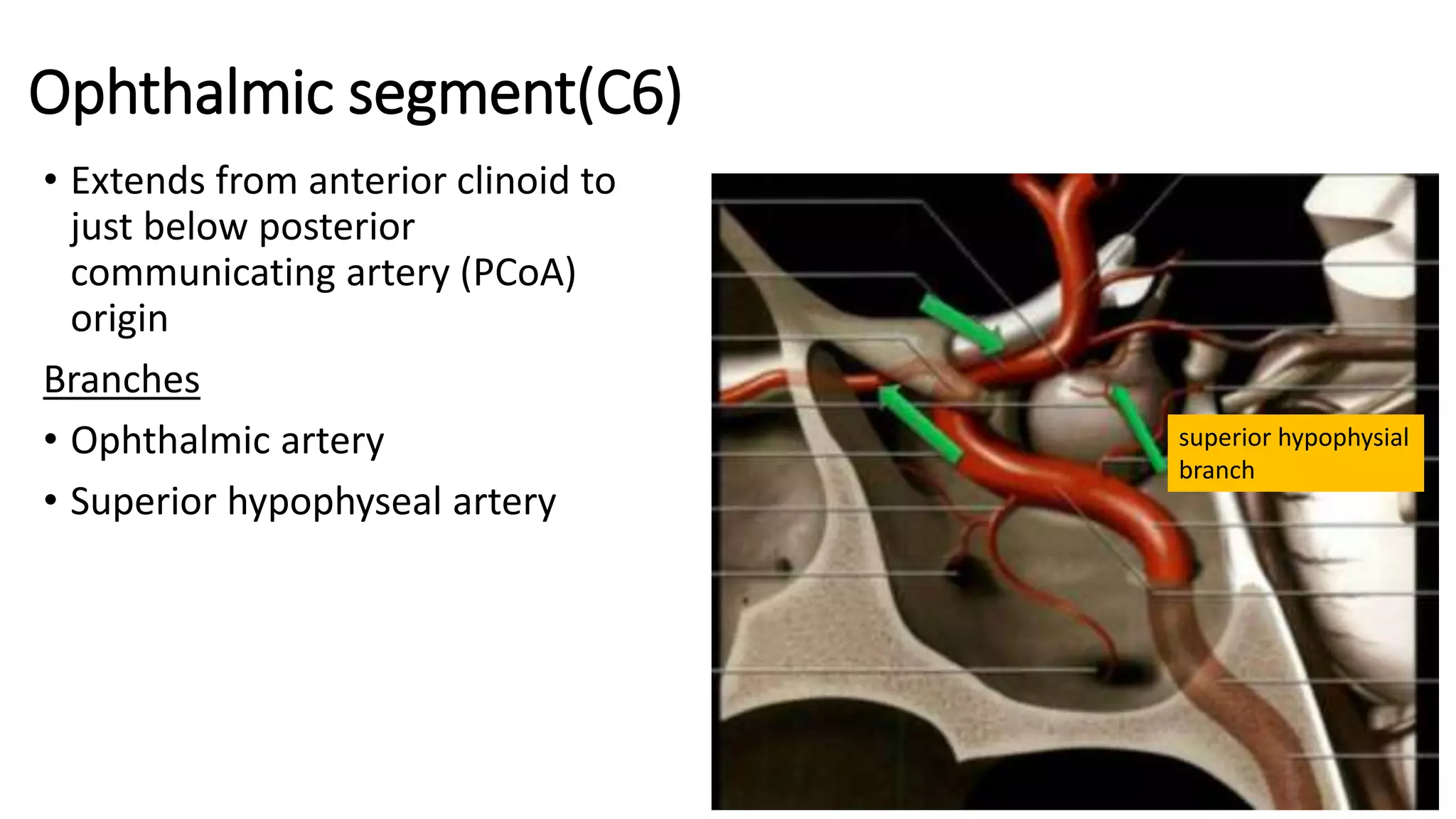 Ophthalmic segment(C6)
• Extends from anterior clinoid to
just below posterior
communicating artery (PCoA)
origin
Branches
• Ophthalmic artery
• Superior hypophyseal artery
superior hypophysial
branch
 