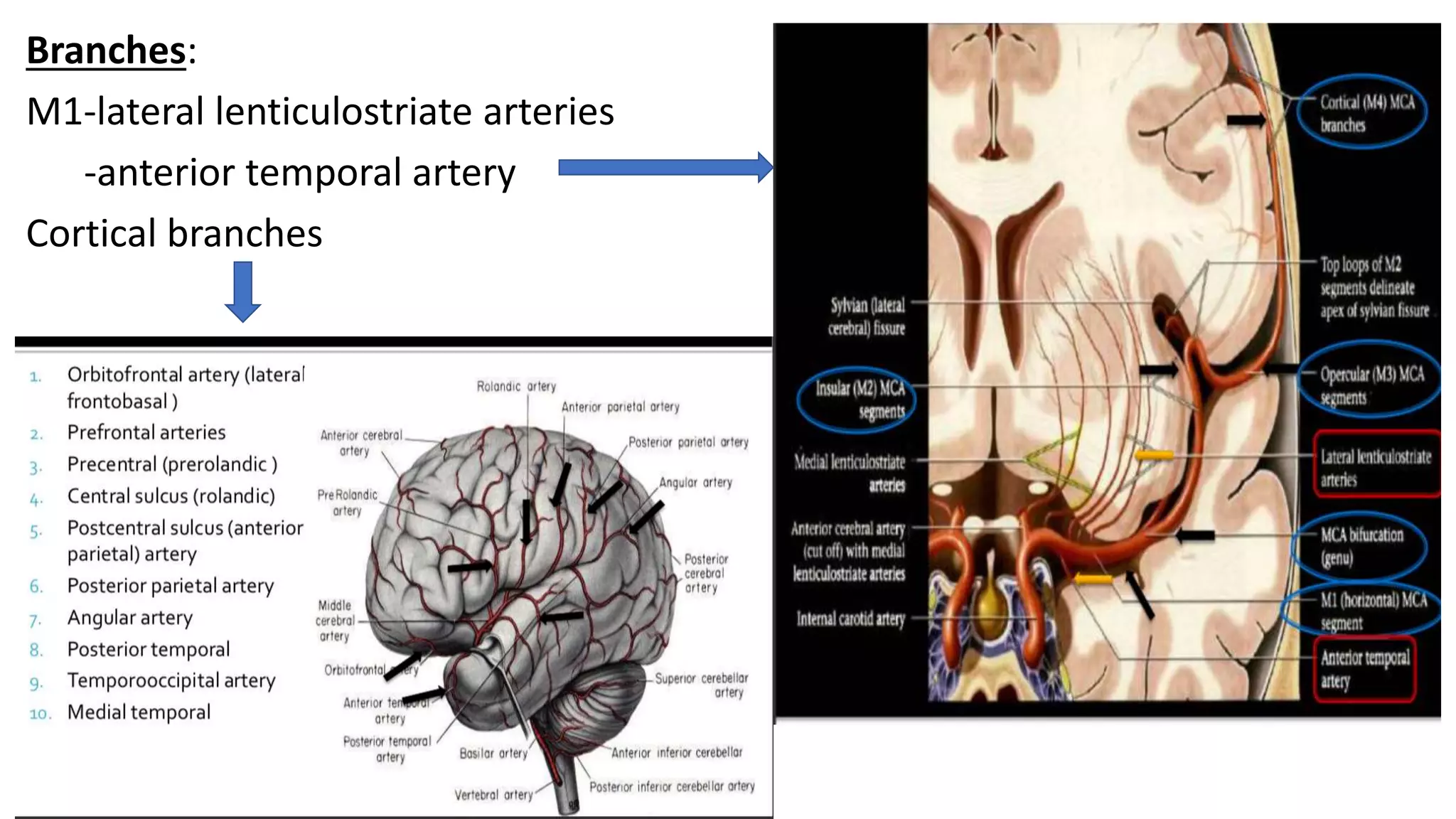 Branches:
M1-lateral lenticulostriate arteries
-anterior temporal artery
Cortical branches
 