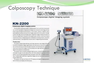 Colposcopy Technique 
