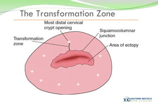 The Transformation Zone 