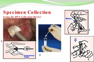Specimen Collection  Using the DNA Collection Device 1 2 3 4 