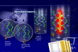 digene Hybrid Capture 2  ® Denature  Physiologic specimen Hybridize with  full-length RNA  probe Capture  and detect  hybrids Sensitive  Luminescence 