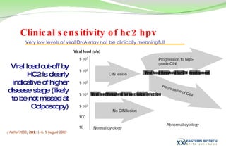Viral load cut-off by HC2 is clearly indicative of higher disease stage (likely to be  not missed  at Colposcopy) J Pathol  2003;  201 : 1–6. 5 August 2003  Very low levels of viral DNA may not be clinically meaningful! Clinical sensitivity of hc2 hpv Viral load threshold for CIN development Viral load threshold for no clinical infection 