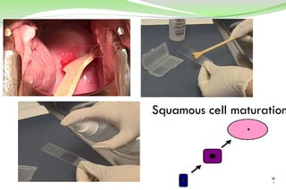 Squamous cell maturation 