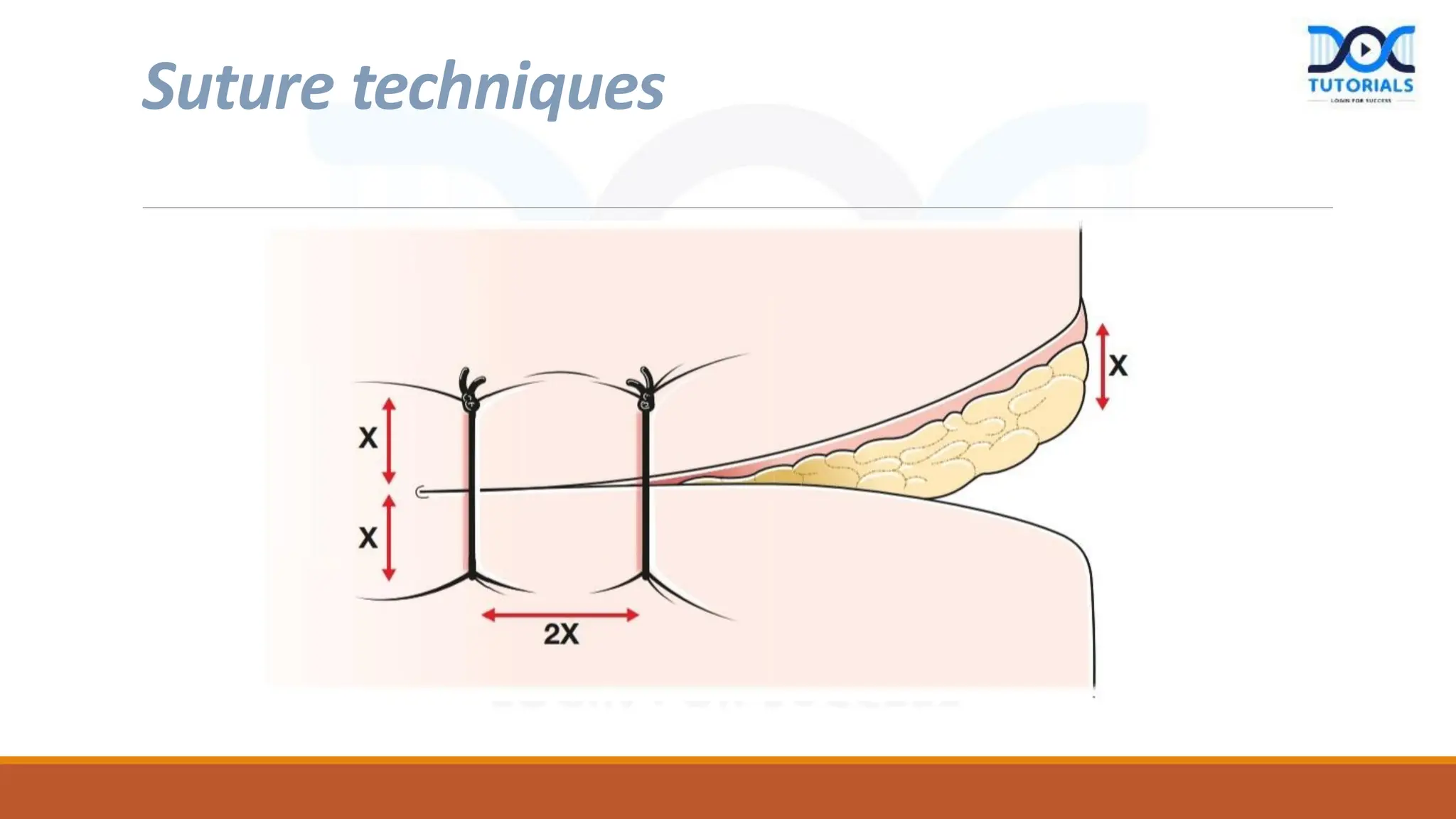 BASIC SURGICAL SKILL AND ANASTOMOSES (2).pdf