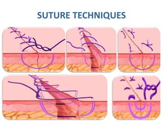 Basic surgical skills | PPTX