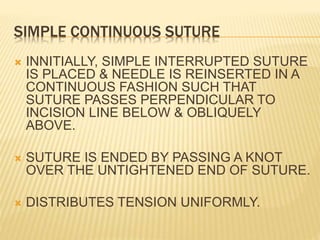 Simple Continuous Pattern Surgery Basic surgical skills | PPTX