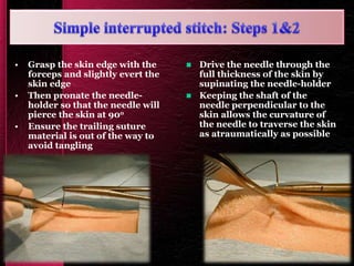 • Grasp the skin edge with the
forceps and slightly evert the
skin edge
• Then pronate the needle-
holder so that the needle will
pierce the skin at 90o
• Ensure the trailing suture
material is out of the way to
avoid tangling
 Drive the needle through the
full thickness of the skin by
supinating the needle-holder
 Keeping the shaft of the
needle perpendicular to the
skin allows the curvature of
the needle to traverse the skin
as atraumatically as possible
 