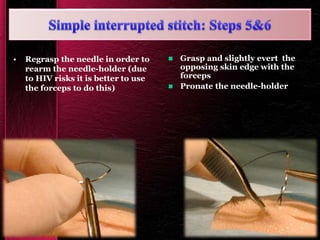 • Regrasp the needle in order to
rearm the needle-holder (due
to HIV risks it is better to use
the forceps to do this)
 Grasp and slightly evert the
opposing skin edge with the
forceps
 Pronate the needle-holder
 