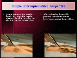 • Again, supinate the needle-
holder to rotate the needle
through the skin, keeping the
shaft 90° to the skin surface
• After releasing the needle,
pronate the needle-holder
before regrasping the needle…
 