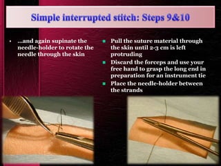• …and again supinate the
needle-holder to rotate the
needle through the skin
 Pull the suture material through
the skin until 2-3 cm is left
protruding
 Discard the forceps and use your
free hand to grasp the long end in
preparation for an instrument tie
 Place the needle-holder between
the strands
 