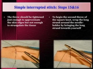 • The throw should be tightened
just enough to approximate
the skin edges but not enough
to strangulate the tissue
• To begin the second throw of
the square knot, wrap the long
strand around the needle-
holder by bringing the long
strand towards yourself
 