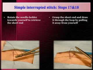 • Rotate the needle-holder
towards yourself to retrieve
the short end
• Grasp the short end and draw
it through the loop by pulling
it away from yourself
 