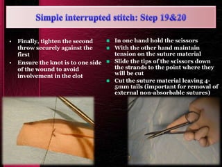 • Finally, tighten the second
throw securely against the
first
• Ensure the knot is to one side
of the wound to avoid
involvement in the clot
 In one hand hold the scissors
 With the other hand maintain
tension on the suture material
 Slide the tips of the scissors down
the strands to the point where they
will be cut
 Cut the suture material leaving 4-
5mm tails (important for removal of
external non-absorbable sutures)
 