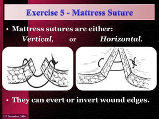 • Mattress sutures are either:
Vertical, or Horizontal.
• They can evert or invert wound edges.
 