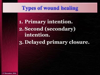 1. Primary intention.
2. Second (secondary)
intention.
3. Delayed primary closure.
 