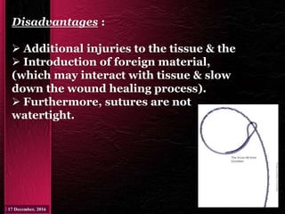 Disadvantages :
 Additional injuries to the tissue & the
 Introduction of foreign material,
(which may interact with tissue & slow
down the wound healing process).
 Furthermore, sutures are not
watertight.
 