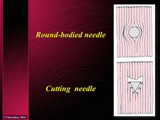 Round-bodied needle
Cutting needle
 