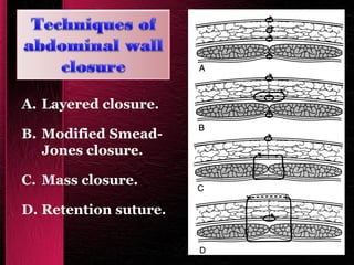 Basic Surgical Skills Final | PPT