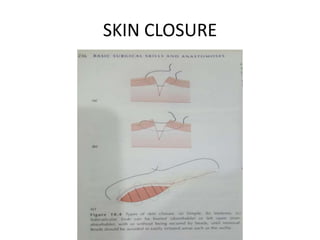 Basic surgical skills | PPTX