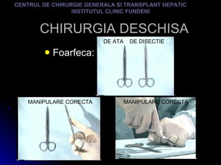CHIRURGIA DESCHISA Foarfeca: CENTRUL DE CHIRURGIE GENERALA SI TRANSPLANT HEPATIC  INSTITUTUL CLINIC FUNDENI DE ATA  DE DISECTIE MANIPULARE CORECTA MANIPULARE CORECTA 