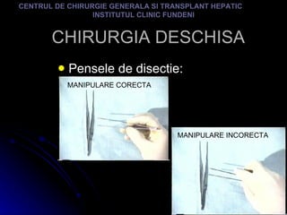 CHIRURGIA DESCHISA Pensele de disectie: CENTRUL DE CHIRURGIE GENERALA SI TRANSPLANT HEPATIC  INSTITUTUL CLINIC FUNDENI MANIPULARE CORECTA MANIPULARE INCORECTA 