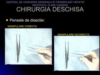 CHIRURGIA DESCHISA Pensele de disectie: CENTRUL DE CHIRURGIE GENERALA SI TRANSPLANT HEPATIC  INSTITUTUL CLINIC FUNDENI MANIPULARE CORECTA MANIPULARE INCORECTA 
