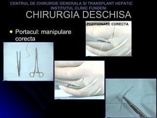 CHIRURGIA DESCHISA Portacul: manipulare corecta CENTRUL DE CHIRURGIE GENERALA SI TRANSPLANT HEPATIC  INSTITUTUL CLINIC FUNDENI POZITIONARE CORECTA 