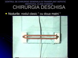 CHIRURGIA DESCHISA Nodurile: nodul clasic “ cu doua maini “ CENTRUL DE CHIRURGIE GENERALA SI TRANSPLANT HEPATIC  INSTITUTUL CLINIC FUNDENI 