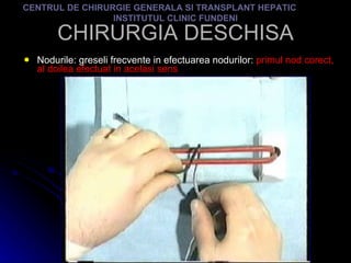 CHIRURGIA DESCHISA Nodurile: greseli frecvente in efectuarea nodurilor:  primul nod corect, al doilea efectuat in acelasi sens CENTRUL DE CHIRURGIE GENERALA SI TRANSPLANT HEPATIC  INSTITUTUL CLINIC FUNDENI 