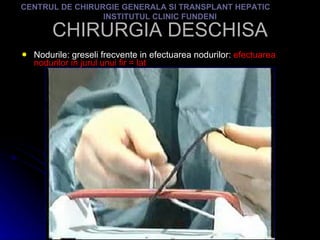 CHIRURGIA DESCHISA Nodurile: greseli frecvente in efectuarea nodurilor:  efectuarea nodurilor in jurul unui fir = lat CENTRUL DE CHIRURGIE GENERALA SI TRANSPLANT HEPATIC  INSTITUTUL CLINIC FUNDENI 