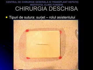 CHIRURGIA DESCHISA Tipuri de sutura: surjet – rolul asistentului CENTRUL DE CHIRURGIE GENERALA SI TRANSPLANT HEPATIC  INSTITUTUL CLINIC FUNDENI 