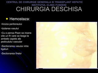 CHIRURGIA DESCHISA Hemostaza: CENTRUL DE CHIRURGIE GENERALA SI TRANSPLANT HEPATIC  INSTITUTUL CLINIC FUNDENI Incizia peritoneului Izolarea vasului Cu o pensa Pean se insera cite un fir care se leaga la ambele capete ale pediculului vascular Sectionarea vasului intre ligaturi Sectionarea firelor 