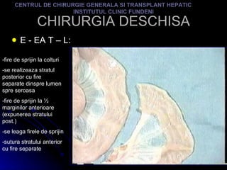 CHIRURGIA DESCHISA E - EA T – L: CENTRUL DE CHIRURGIE GENERALA SI TRANSPLANT HEPATIC  INSTITUTUL CLINIC FUNDENI -fire de sprijin la colturi -se realizeaza stratul posterior cu fire separate dinspre lumen spre seroasa -fire de sprijin la ½ marginilor anterioare (expunerea stratului post.) -se leaga firele de sprijin -sutura stratului anterior cu fire separate 