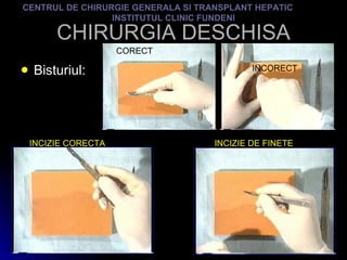 CHIRURGIA DESCHISA Bisturiul: CENTRUL DE CHIRURGIE GENERALA SI TRANSPLANT HEPATIC  INSTITUTUL CLINIC FUNDENI CORECT INCORECT INCIZIE CORECTA INCIZIE DE FINETE 