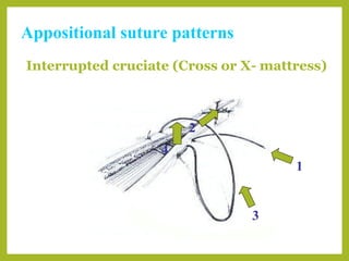 Basic suture patterns | PPT
