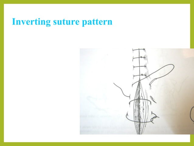 Basic suture patterns