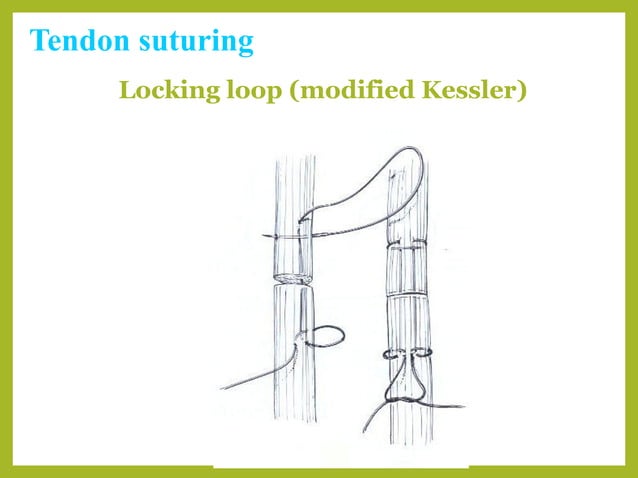 Basic suture patterns